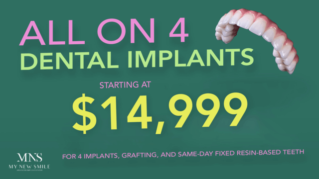 Dental Implant Center in Nashville, TN | My New Smile Dental