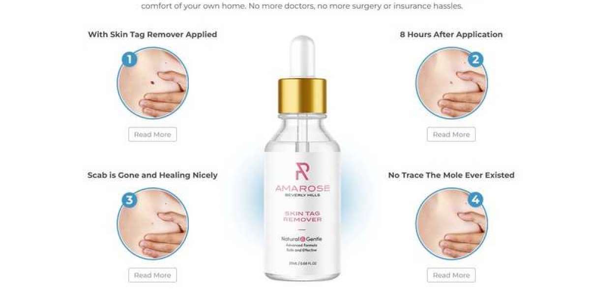 Five Benefits Of Amarose Skin Tag Remover Reviews That May Change Your Perspective!