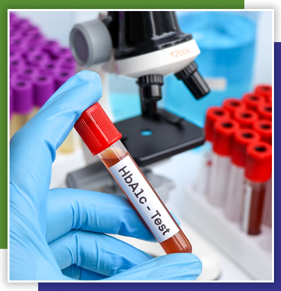 HbA1c Test in Chandigarh | HbA1c Test Lab in Chandigarh