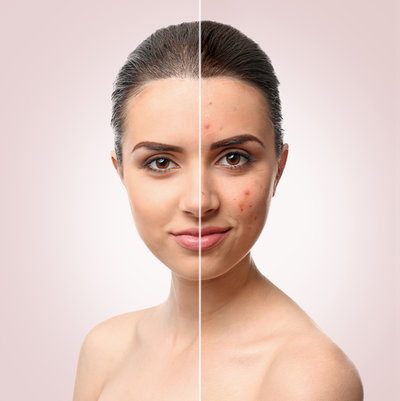 Best skin treatment in india - Medicturist.com