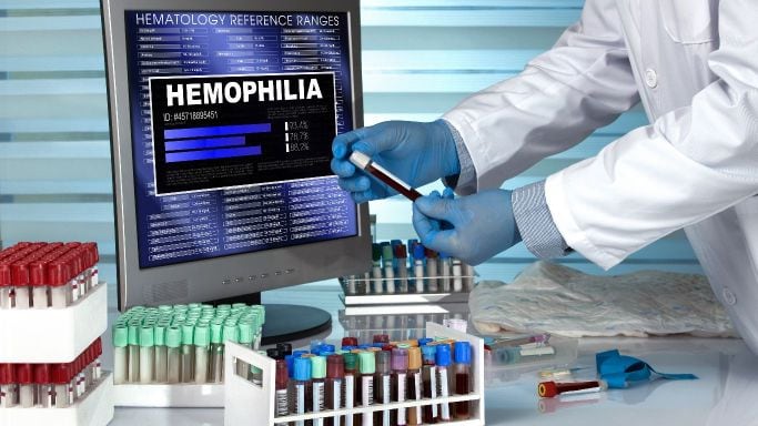 Global Hemophilia Treatment Market Size, Share | Industry Analysis 2027