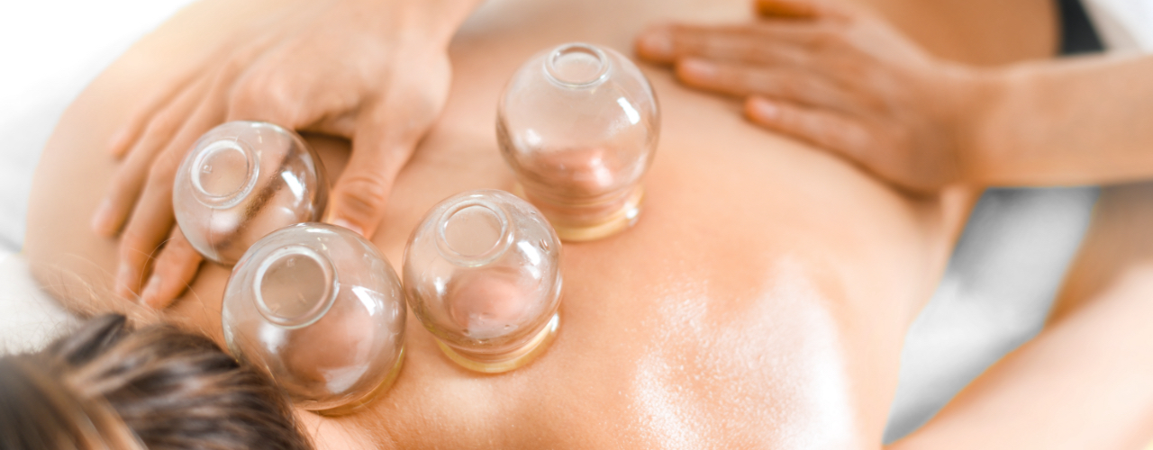 Cupping Sterling Heights, MI - Back 2 Health Physical Therapy