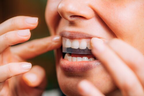 Worried About Teeth Stains? Here's How to Prevent & Treat Discoloration Safely
