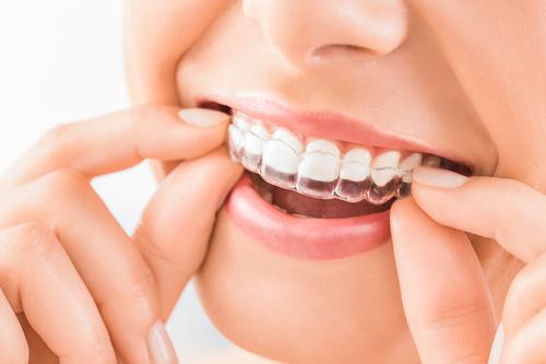 Invisalign Treatment in India | Invisalign Cost