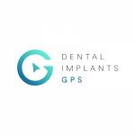 Dental Implants GPS Profile Picture