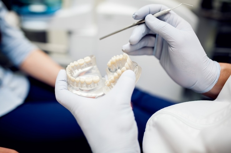 Top 3 Reasons Dental Implants in Philadelphia Are So Popular | SMG