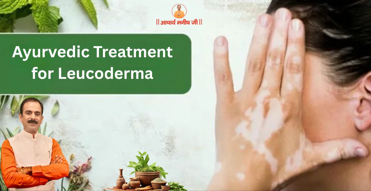 Ayurvedic Treatment for Leucoderma