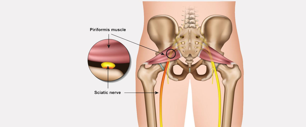 5 TIPS FOR Å LINDRE ISJIAS SMERTER– NuroKor Norge