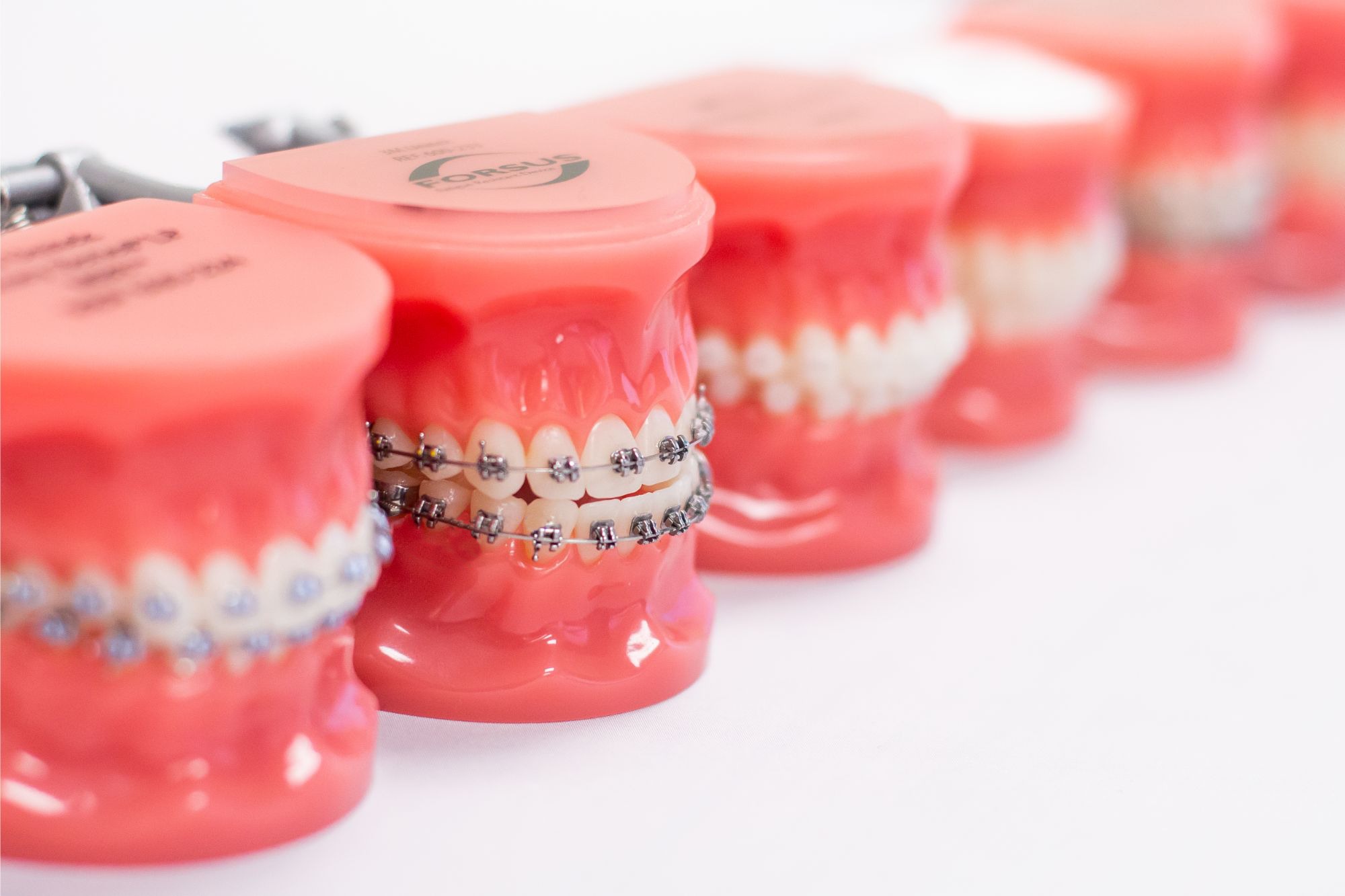 Treatment Options - Ossi Orthodontics - Braces - Invisalign